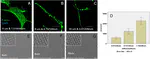 New Paper: Preferential sensing and response to microenvironment stiffness of human dermal fibroblast cultured on protein micropatterns fabricated by 3D multiphoton biofabrication