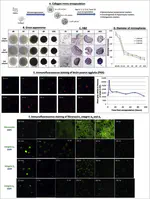 New Paper: Collagen microencapsulation recapitulates mesenchymal condensation and potentiates chondrogenesis of human mesenchymal stem cells – A matrix-driven in vitro model of early skeletogenesis