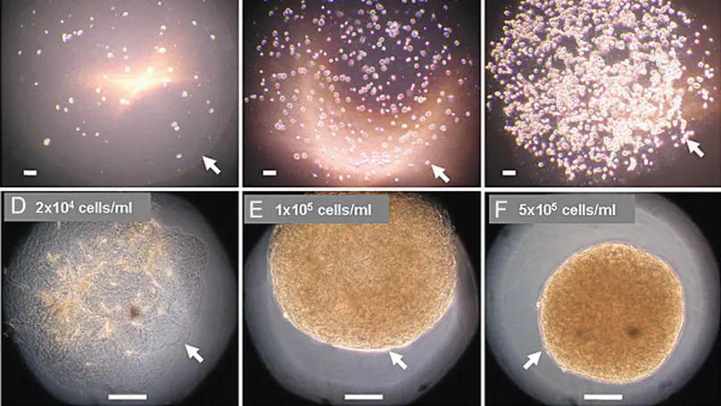 Self-Assembled Collagen-Human Mesenchymal Stem Cell Microspheres for Regenerative Medicine