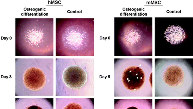 Mesenchymal Stem Cell-Encapsulated Collagen Microspheres for Bone Tissue Engineering