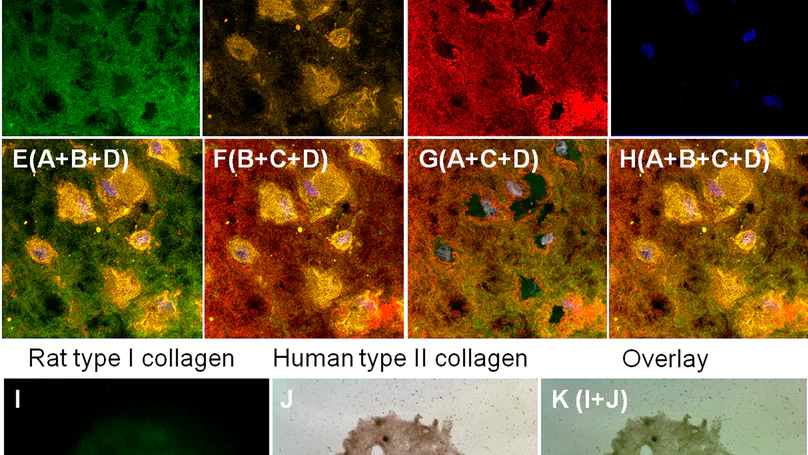 Extracellular Protease Inhibition Alters the Phenotype of Chondrogenically Differentiating Human Mesenchymal Stem Cells (MSCs) in 3D Collagen Microspheres