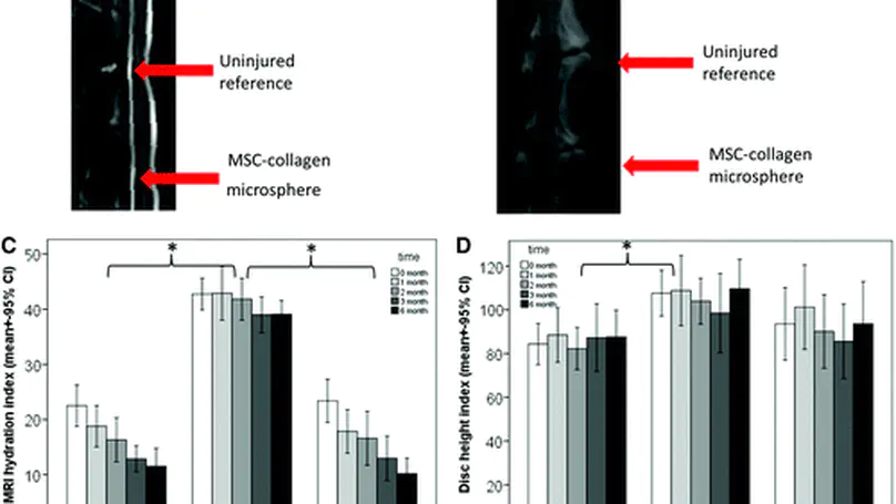Delivering Mesenchymal Stem Cells in Collagen Microsphere Carriers to Rabbit Degenerative Disc: Reduced Risk of Osteophyte Formation
